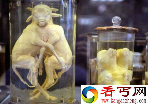 毛骨悚然!收藏畸形人遗体的尸体博物馆