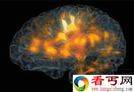 成像技术观察大脑活动 全新的体验病人的福音
