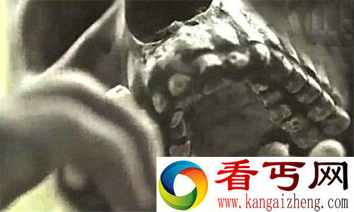 人类史前文明巨人骨骸竟是外星人化石