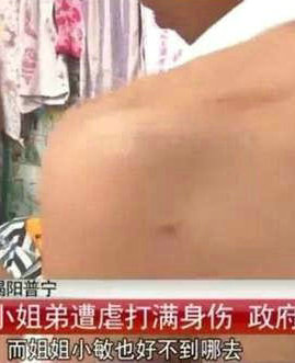 广东揭阳十几岁姐弟被亲爹继母虐打7年体无完肤