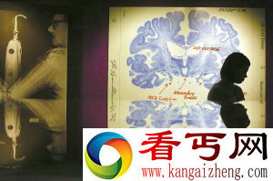 　　人类大脑切片幻灯片。