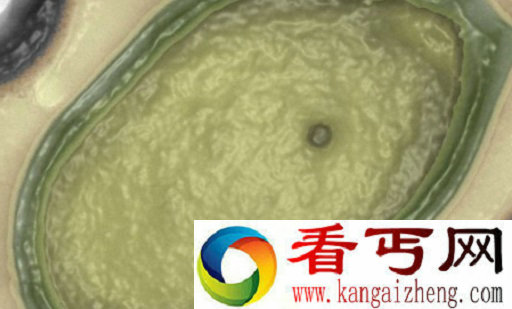世界上最大的病毒