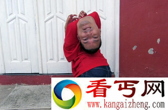最恐怖的怪病