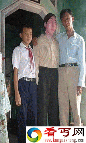 感人!痴情男伴妻尸睡7年