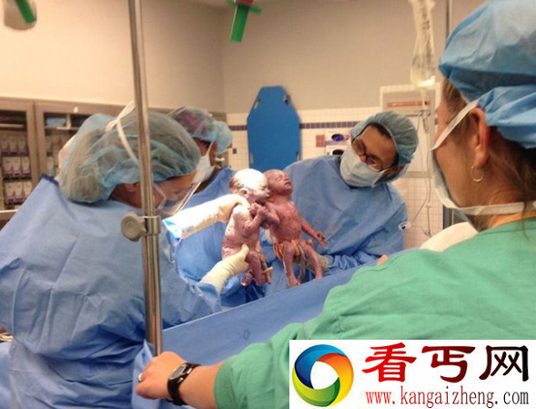 双胞胎手牵手出生
