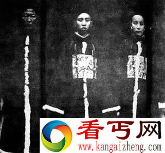 太监割掉的命根子竟可重新复活 但过程残忍