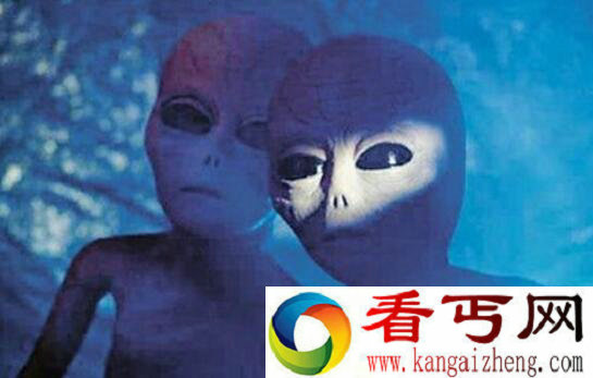 双胞胎眼睛似外星人 没想到竟是这原因