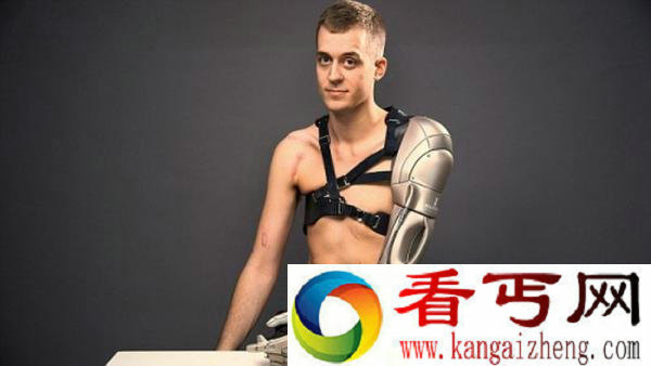 男子装上机械手臂 体验3D打印的未来版仿生手臂