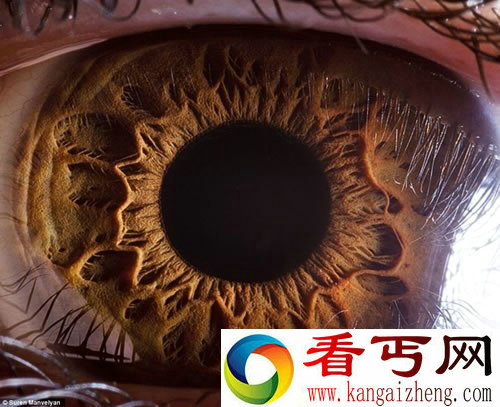 “心灵的窗户” 微距展示人眼虹膜不同寻常的细节
