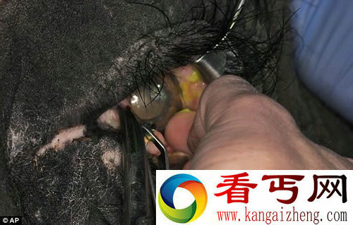 大象的超大号隐形眼镜 能帮助伤口愈合