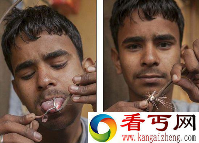 印度男孩可抗11000伏电击 称之为雷神
