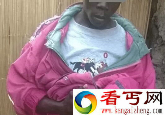 不可思议！非洲一男子丁丁像小婴儿一样大