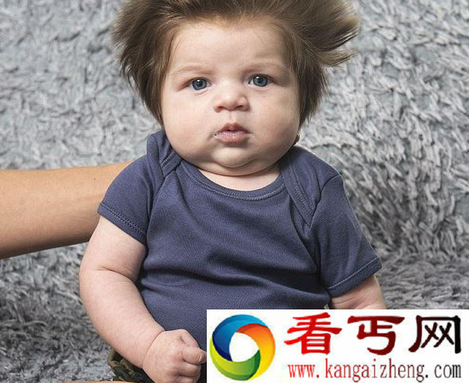 两个月大婴儿头发疯长 理发都要花两小时
