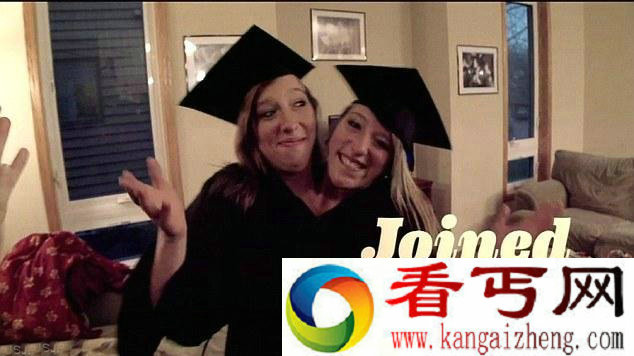 美国双头姐妹共享身体 如今已大学毕业