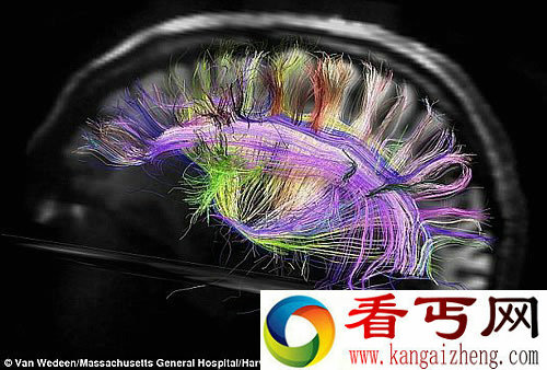 宇宙中最复杂的地形 美妙的人脑内部结构