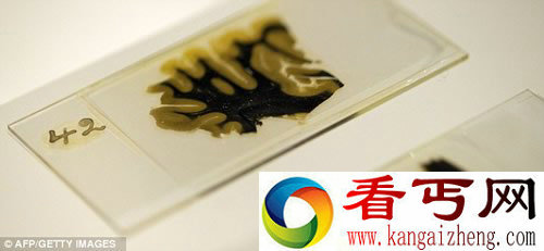 爱因斯坦大脑切片 在英国展出