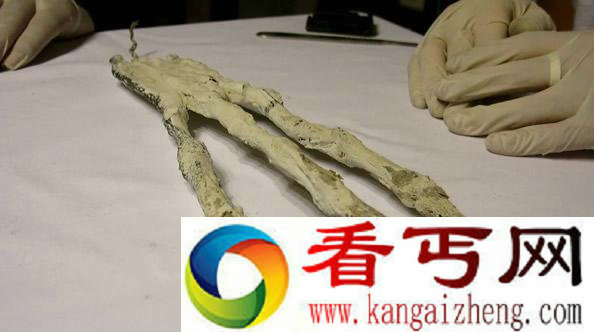 秘鲁发现神秘三指手掌 疑似外星人