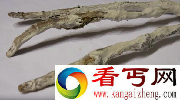 秘鲁发现神秘三指手掌 疑似外星人
