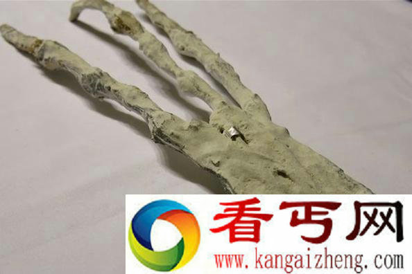 秘鲁发现神秘三指手掌 疑似外星人