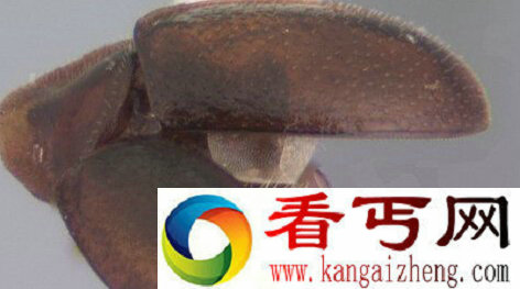 美国学生发现了一种神秘的“缩头昆虫”