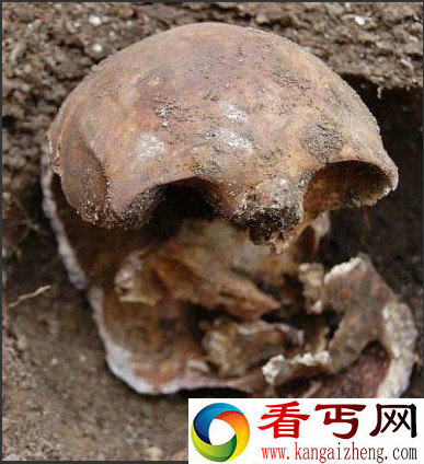 “啃脸男”食人恶魔百年的命案谜团