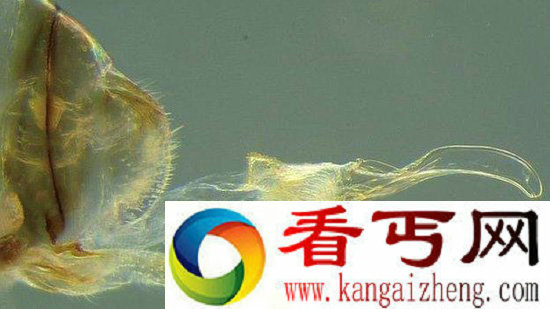 性.器官颠倒的古怪昆虫 可持续交配几十小时