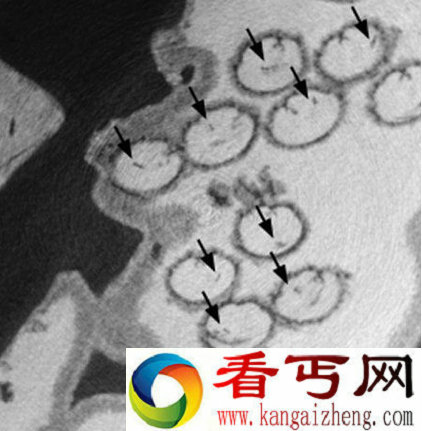 澳大利亚昆士兰州发现最古老精子现身1700万年化石中