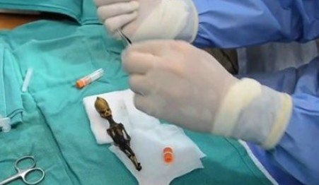 [图文]最新UFO记录片声称发现一具袖珍外星人尸体