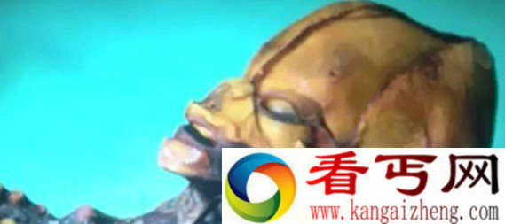 [图文]揭开了所谓的“迷你外星人”骨架的真面目