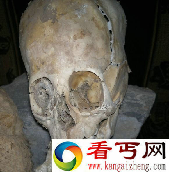 [图文]秘鲁发现两具巨头干尸!疑似外星人遗骸