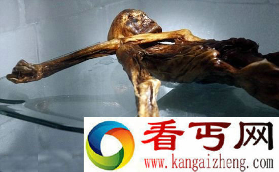 [图文]冰人“奥茨”血液样本研究发现