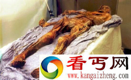 [图文]冰人“奥茨”血液样本研究发现