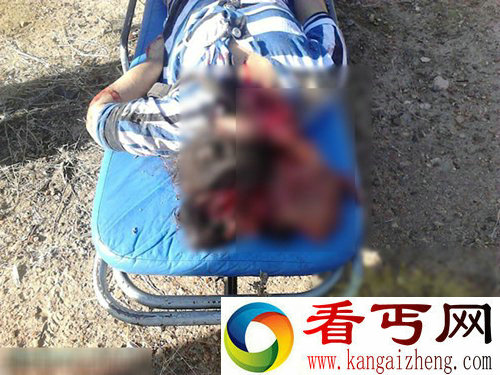 悲剧车祸两美女被卡车削掉MM 下体裸露