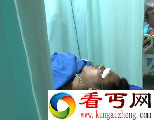 某男子被“洋辣子”蛰后伴随休克症状