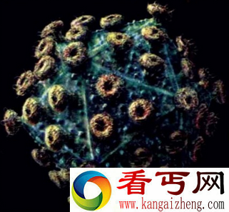 艾滋病起源之谜 这种病毒到底从哪里来？