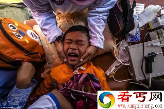 恐怖集体割礼现场 阴茎包皮被割除