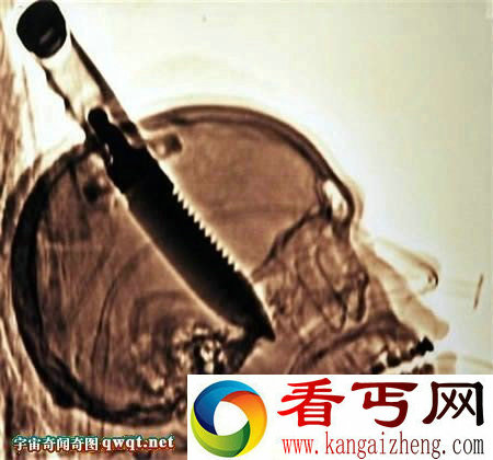 世界上不可思议的恶心记录1分钟吃36只蟑螂