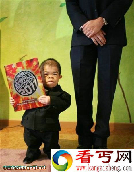 世界最矮男子身高仅70厘米  新晋亮相自豪称独一无二