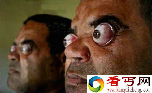 爆眼达人演绎纯天然爆眼特效