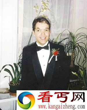 不可思议！美国男子心脏挂体外竟能存活下来