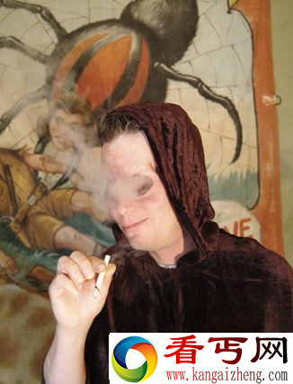 美国男子竟然用左眼的窟窿喝酒