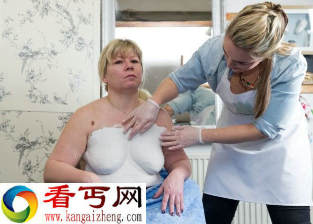 实拍英乳癌母亲术前为胸部做石膏模型(组图)