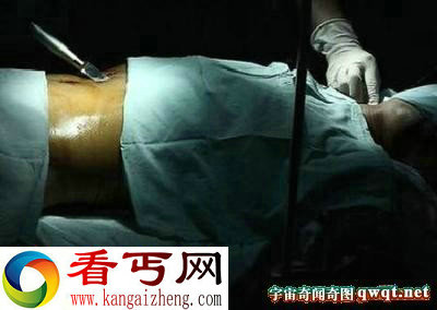 为挽回女友 痴情男自捅三刀表真心
