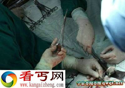 为挽回女友 痴情男自捅三刀表真心