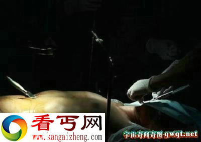为挽回女友 痴情男自捅三刀表真心