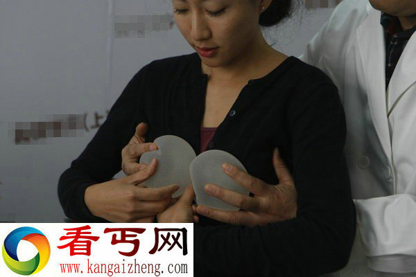 女导游国外隆胸整形失败变大小胸