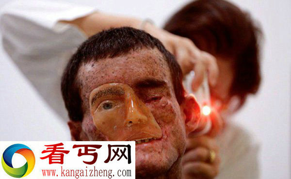 巴西现鬼镇 这里的居民得皮肤病终日见不得阳光
