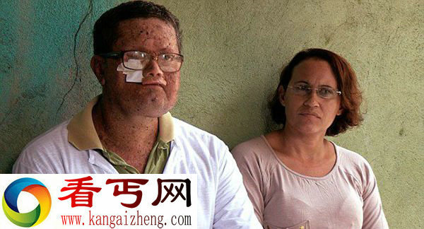 巴西现鬼镇 这里的居民得皮肤病终日见不得阳光