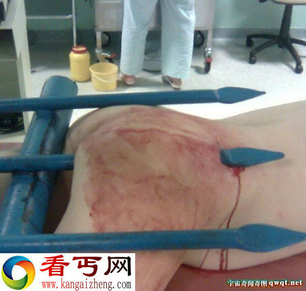 裸女被防护栏杆直插屁股 菊花都爆了