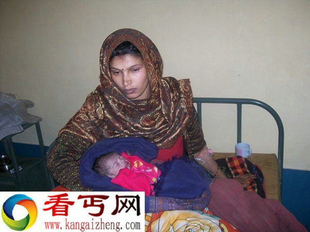 印度一新生儿心脏异位已奇迹存活6天 在当地接受治疗